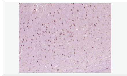 60595b3615bbd.png image.png